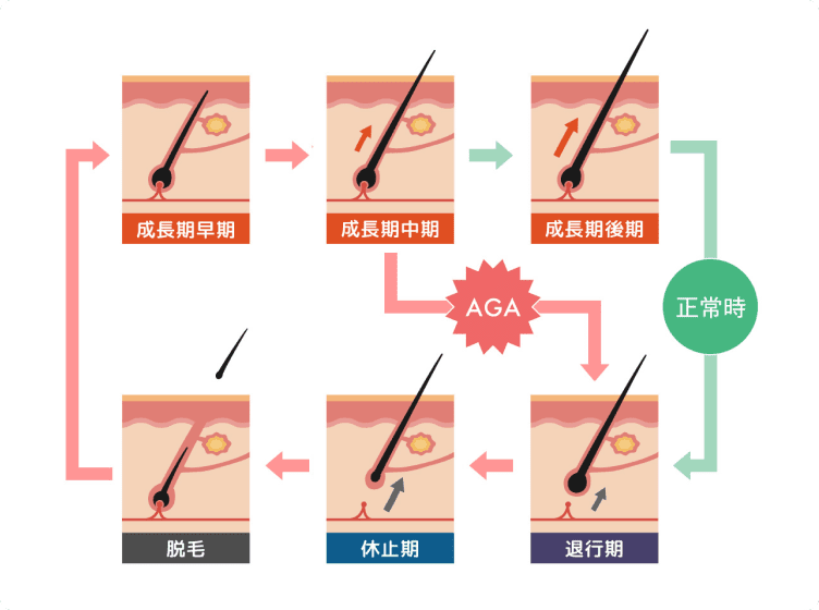 グリーンピールは免疫細胞へ働く